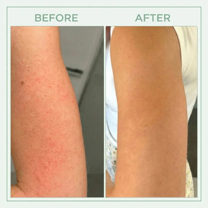 Core Skin™ Bright Peel Spray